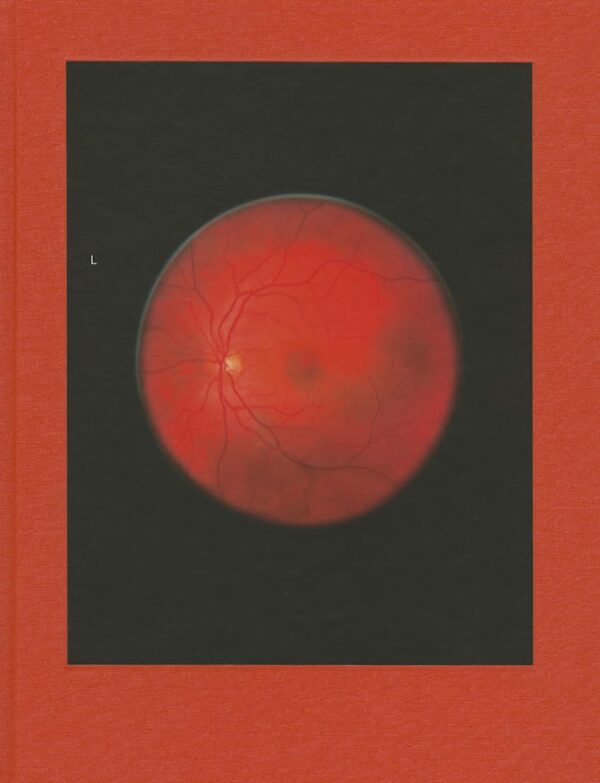 Mikhael Subotzky. Retinal Shift