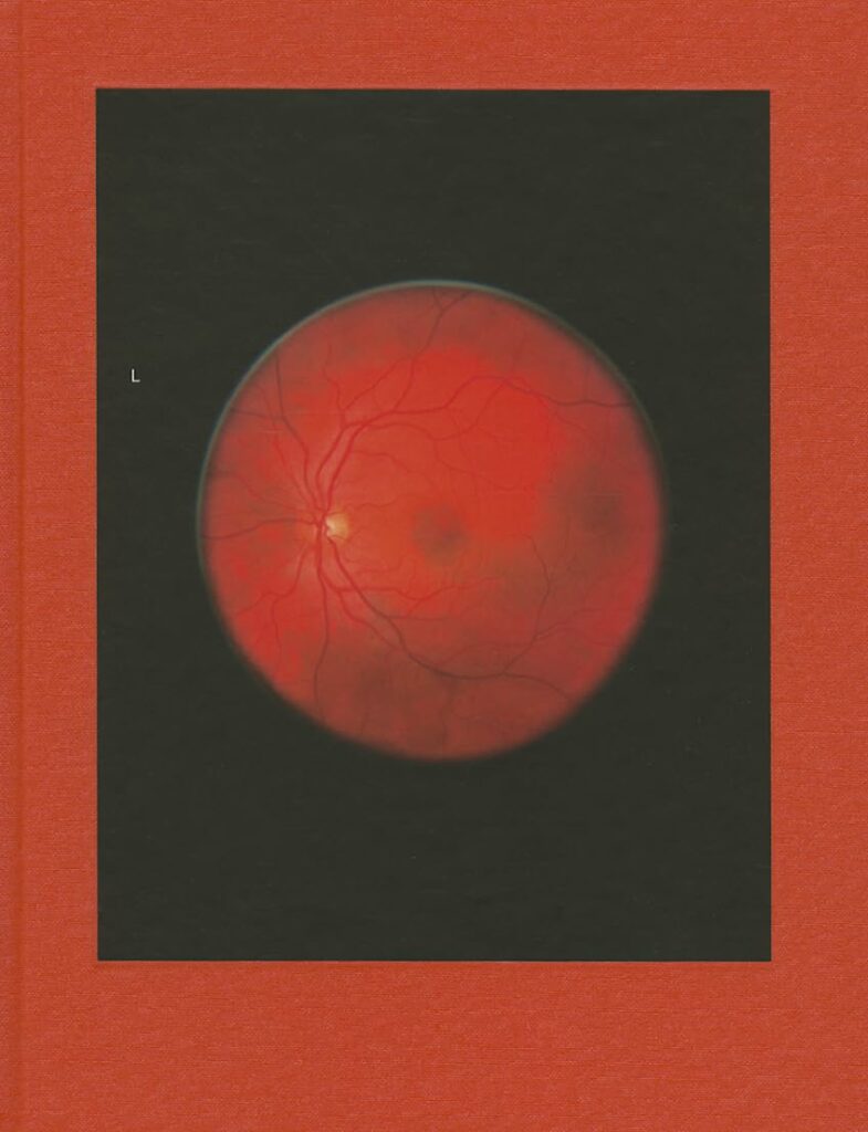 Mikhael Subotzky. Retinal Shift